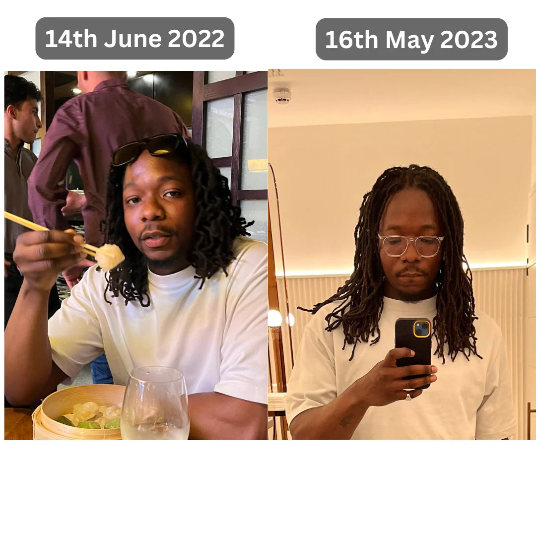 The Ultimate Hair Growth Set for Black Hair