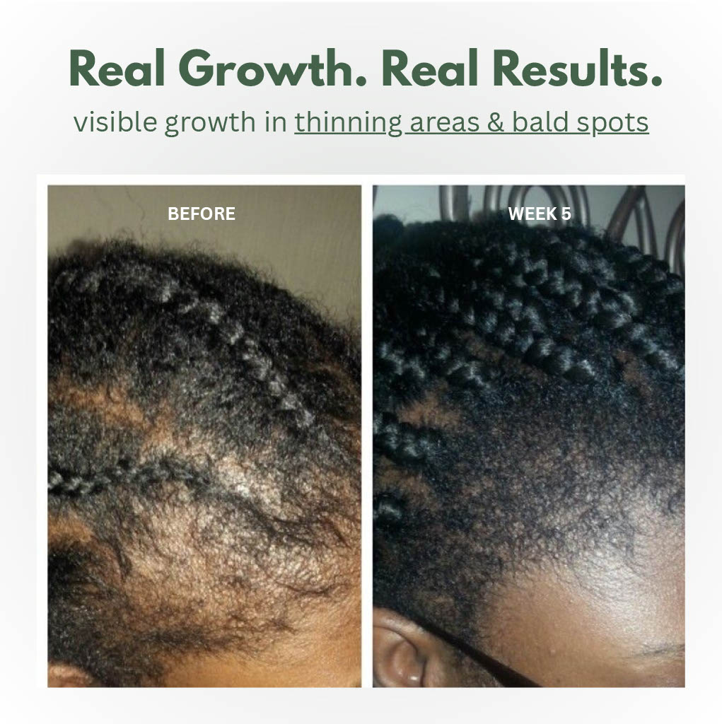 Batana Scalp Serum