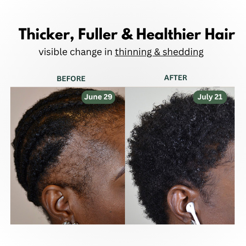 Batana Natural Hair Growth Oil