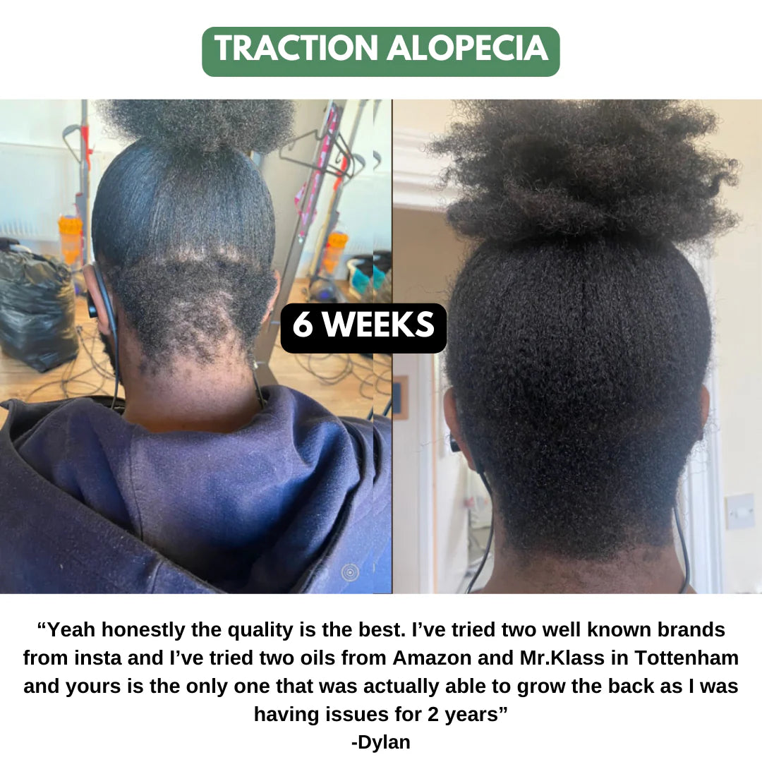 The Ultimate Hair Growth Set for Black Hair
