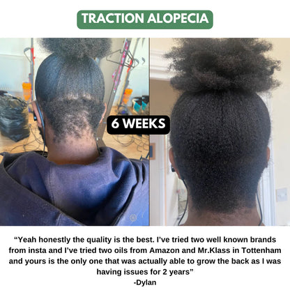 The Ultimate Hair Growth Set for Black Hair