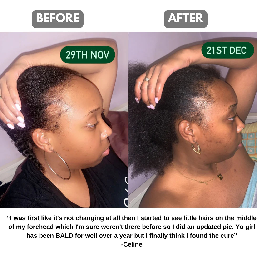 Batana Natural Hair Growth Oil Azure