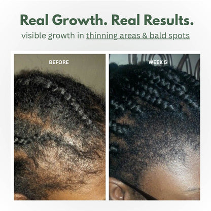 Batana Scalp Serum