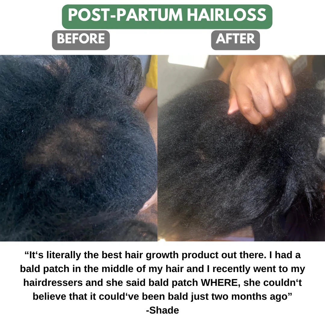 Batana Natural Hair Growth Oil Azure