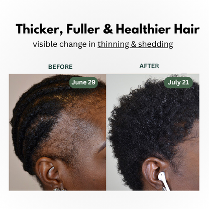 Batana Natural Hair Growth Oil